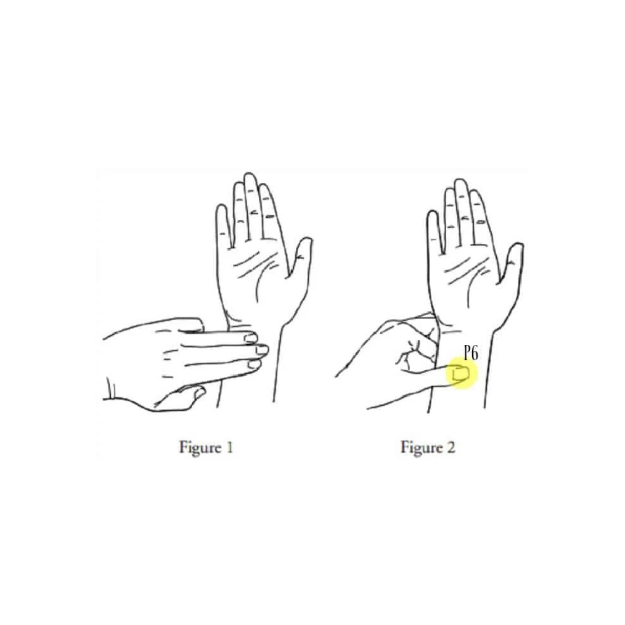 Nausea Relief Bands (Acupressure Wristbands)