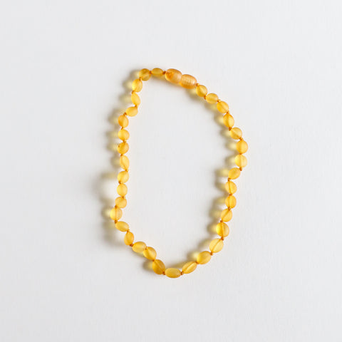 Raw Honey: Classic Amber Necklace | 12"